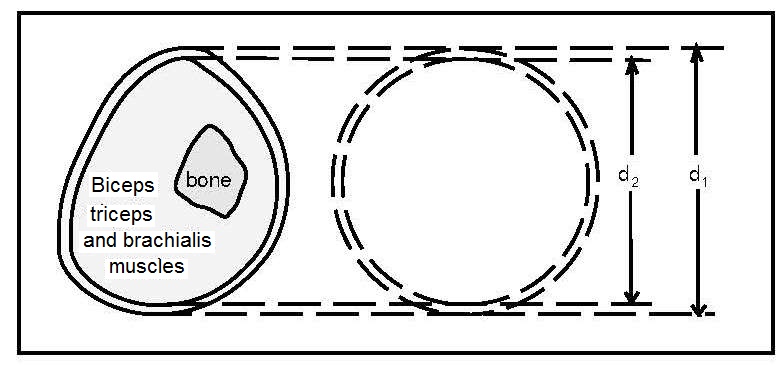 Figure 11.16