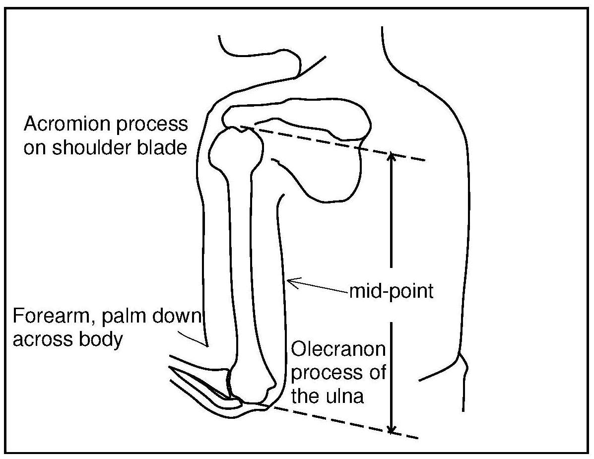 Figure 11.2