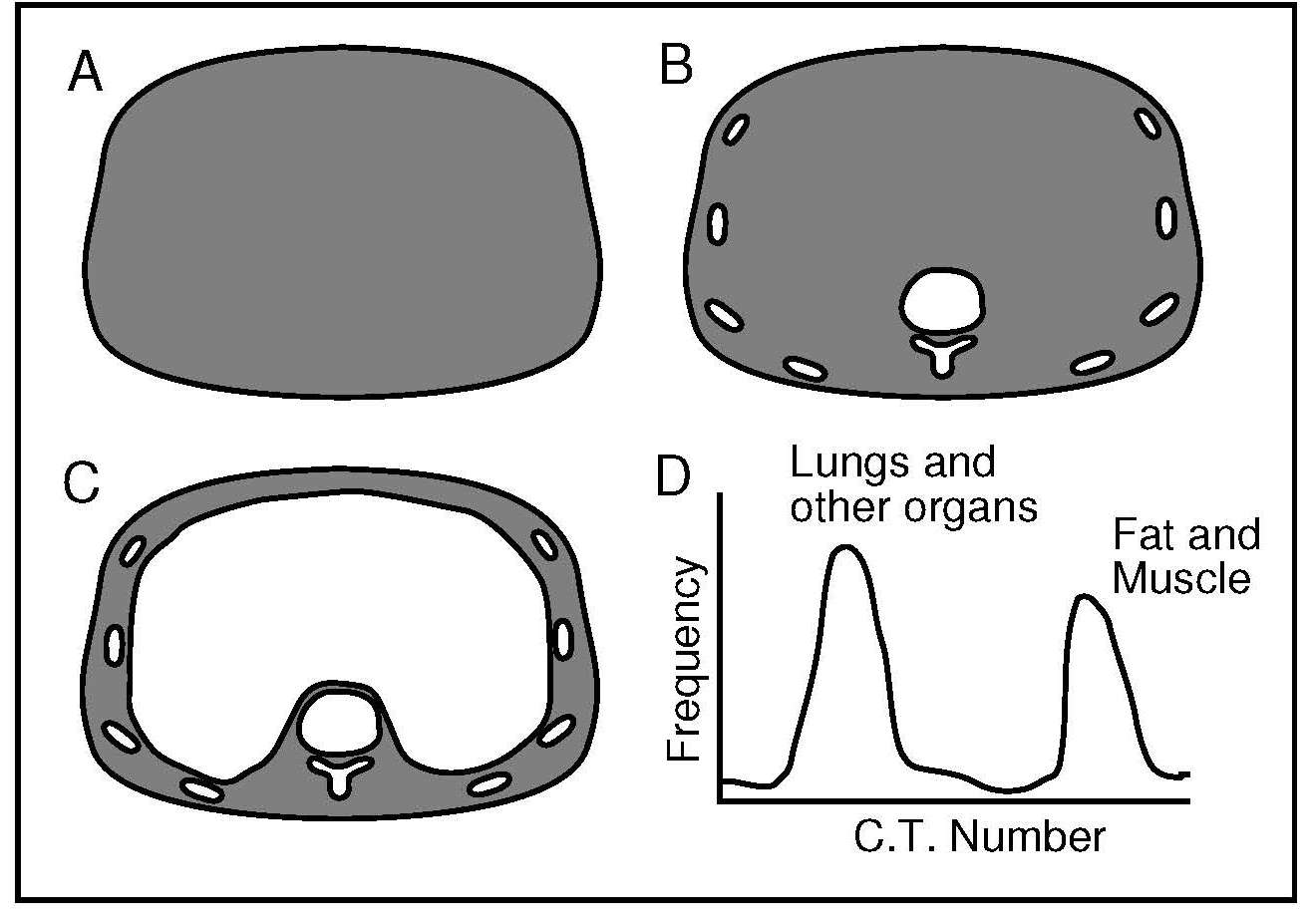 Figure 14.11